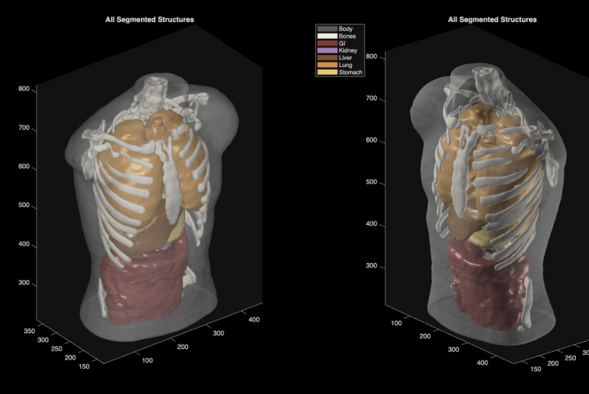 ultrasound_phantom_segmentation-b254a71d083eb5c9